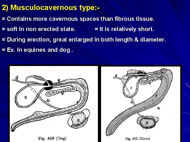 2) Musculocavernous type: = Contains more cavernous spaces than fibrous tissue. = soft in