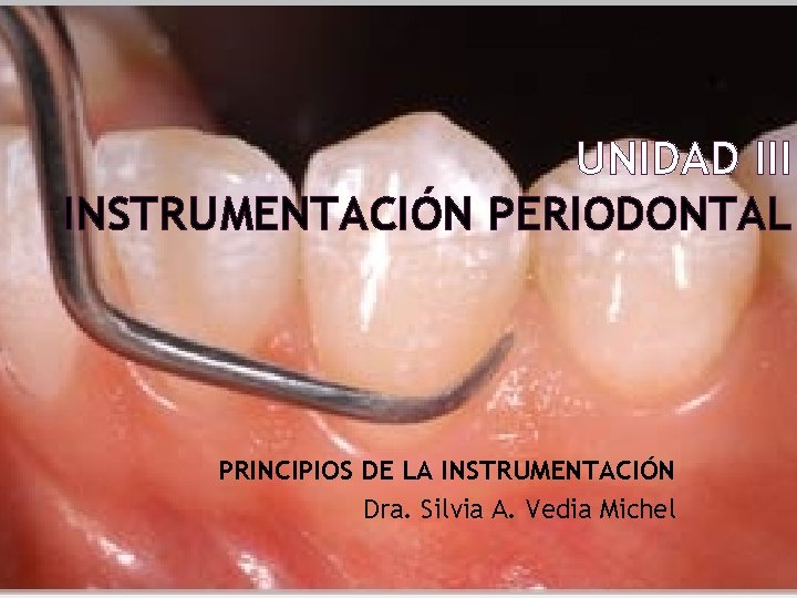 UNIDAD III INSTRUMENTACIÓN PERIODONTAL PRINCIPIOS DE LA INSTRUMENTACIÓN Dra. Silvia A. Vedia Michel 