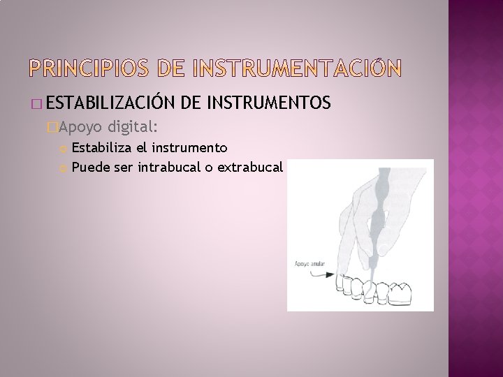 � ESTABILIZACIÓN �Apoyo DE INSTRUMENTOS digital: Estabiliza el instrumento Puede ser intrabucal o extrabucal