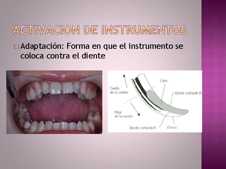 � Adaptación: Forma en que el instrumento se coloca contra el diente 