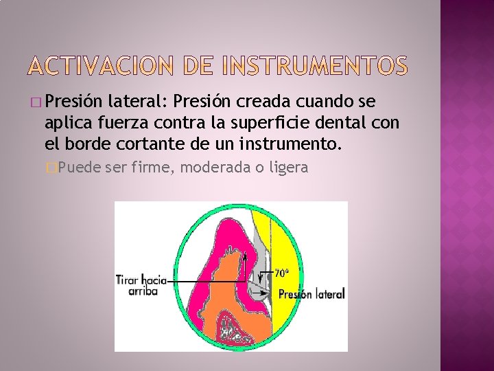 � Presión lateral: Presión creada cuando se aplica fuerza contra la superficie dental con