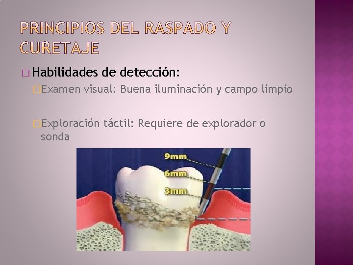 � Habilidades �Examen visual: Buena iluminación y campo limpio �Exploración sonda de detección: táctil:
