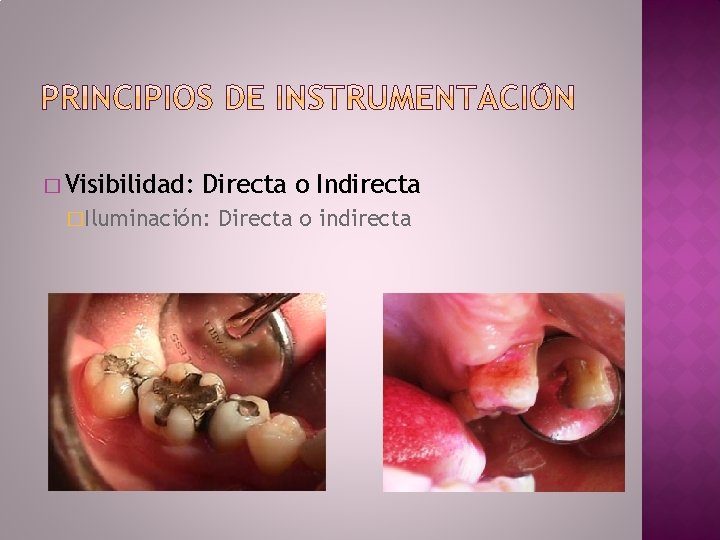 � Visibilidad: Directa o Indirecta �Iluminación: Directa o indirecta 