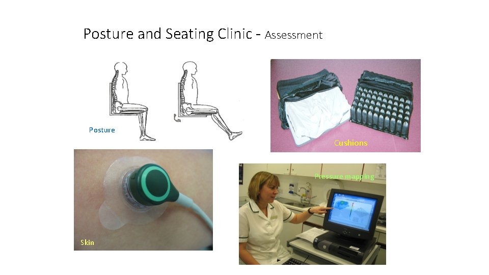 Posture and Seating Clinic - Assessment Posture Cushions Pressure mapping Skin 
