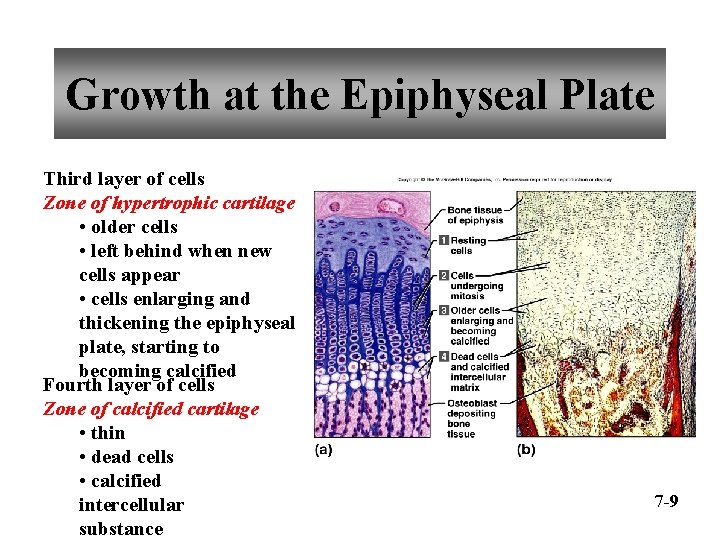 Growth at the Epiphyseal Plate Third layer of cells Zone of hypertrophic cartilage •