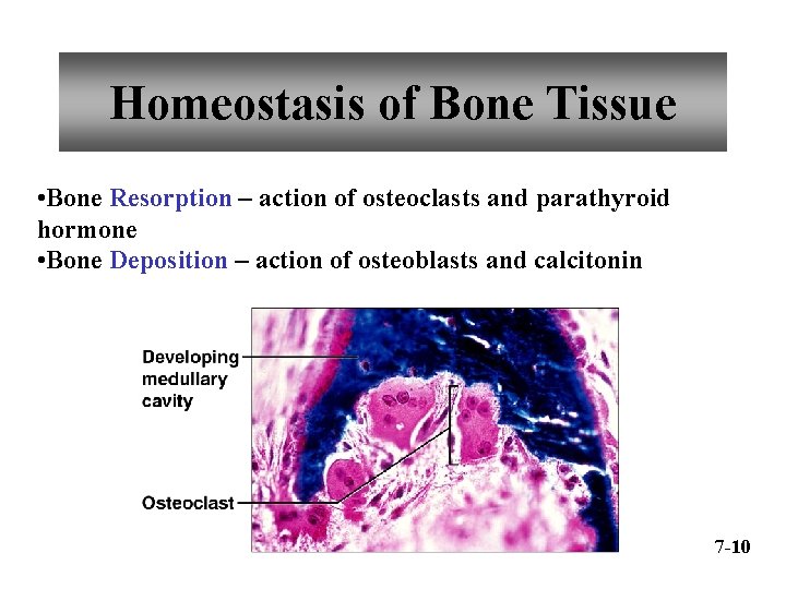 Homeostasis of Bone Tissue • Bone Resorption – action of osteoclasts and parathyroid hormone
