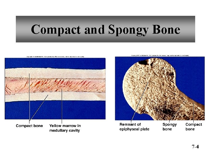 Compact and Spongy Bone 7 -4 