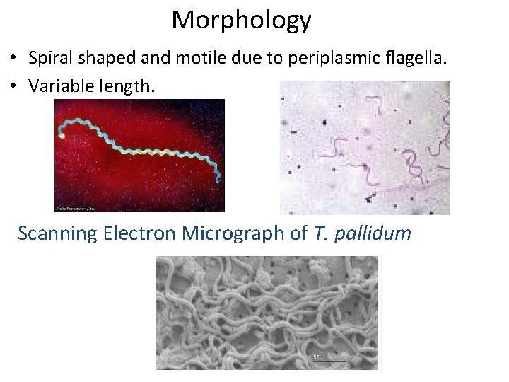 Morphology • Spiral shaped and motile due to periplasmic flagella. • Variable length. Scanning