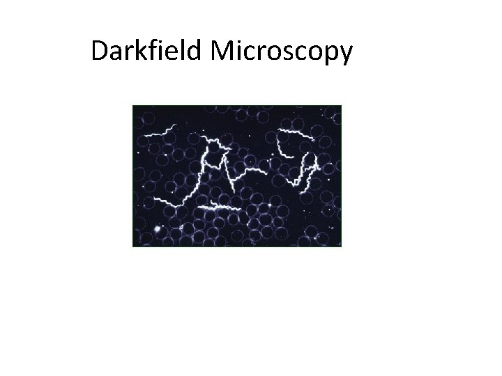 Darkfield Microscopy 