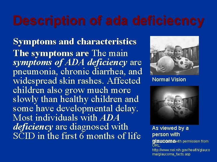 Description of ada deficiecncy Symptoms and characteristics The symptoms are The main symptoms of