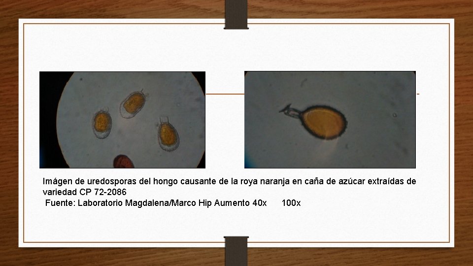 Imágen de uredosporas del hongo causante de la roya naranja en caña de azúcar