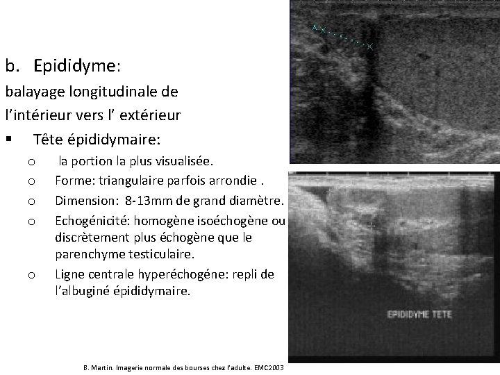 b. Epididyme: balayage longitudinale de l’intérieur vers l’ extérieur § Tête épididymaire: o o