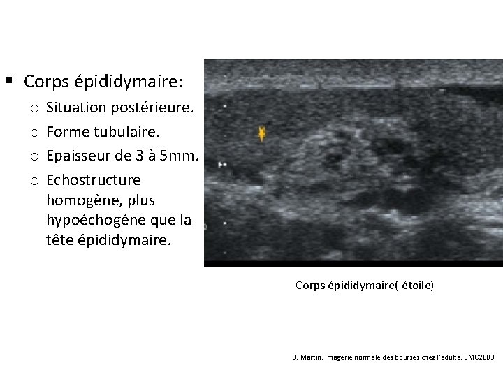 § Corps épididymaire: o o Situation postérieure. Forme tubulaire. Epaisseur de 3 à 5