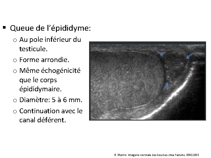 § Queue de l’épididyme: o Au pole inférieur du testicule. o Forme arrondie. o