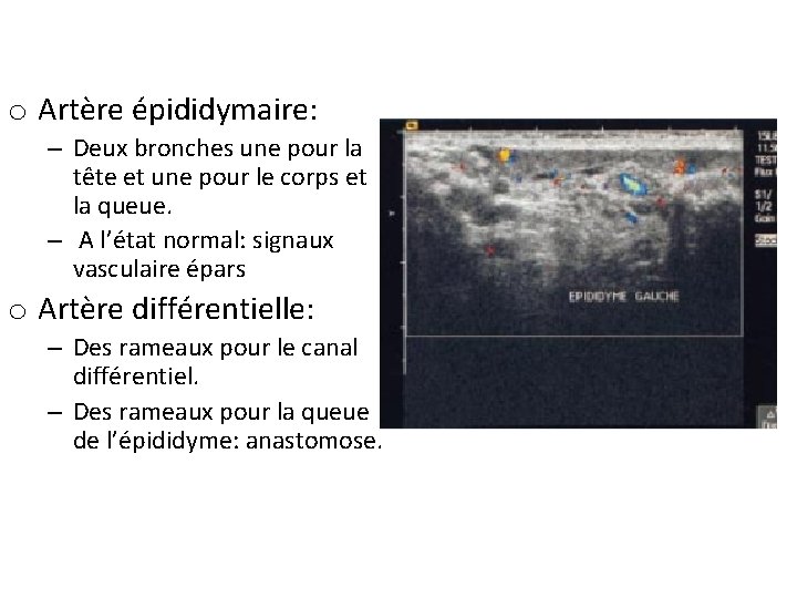 o Artère épididymaire: – Deux bronches une pour la tête et une pour le