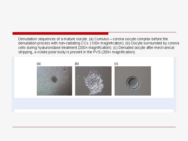 Denudation sequences of a mature oocyte. (a) Cumulus – corona oocyte complex before the