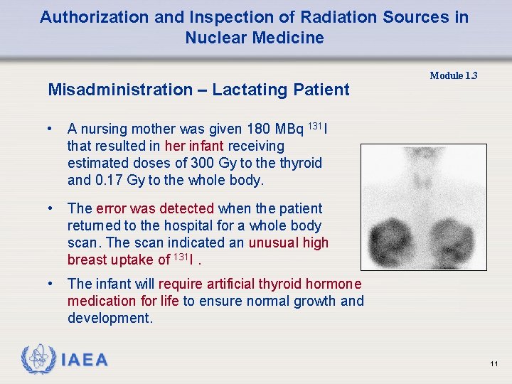 Authorization and Inspection of Radiation Sources in Nuclear Medicine Misadministration – Lactating Patient •