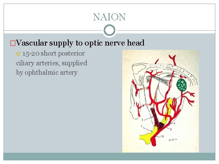 NAION �Vascular supply to optic nerve head 15 -20 short posterior ciliary arteries, supplied