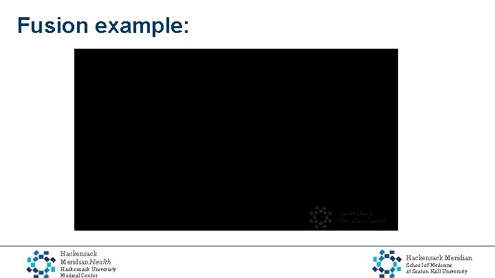 Fusion example: Hackensack Meridian Health Hackensack University Medical Center Hackensack Meridian School of Medicine
