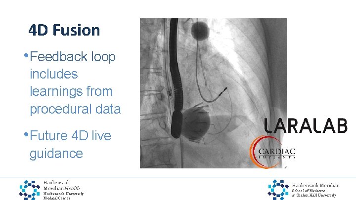 4 D Fusion • Feedback loop includes learnings from procedural data • Future 4