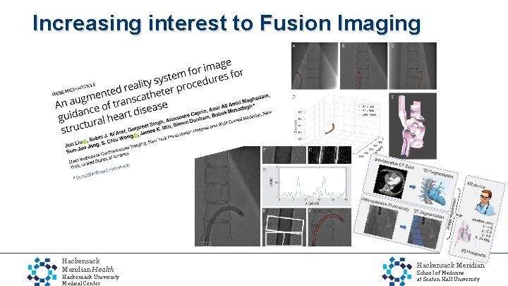 Increasing interest to Fusion Imaging Hackensack Meridian Health Hackensack University Medical Center Hackensack Meridian