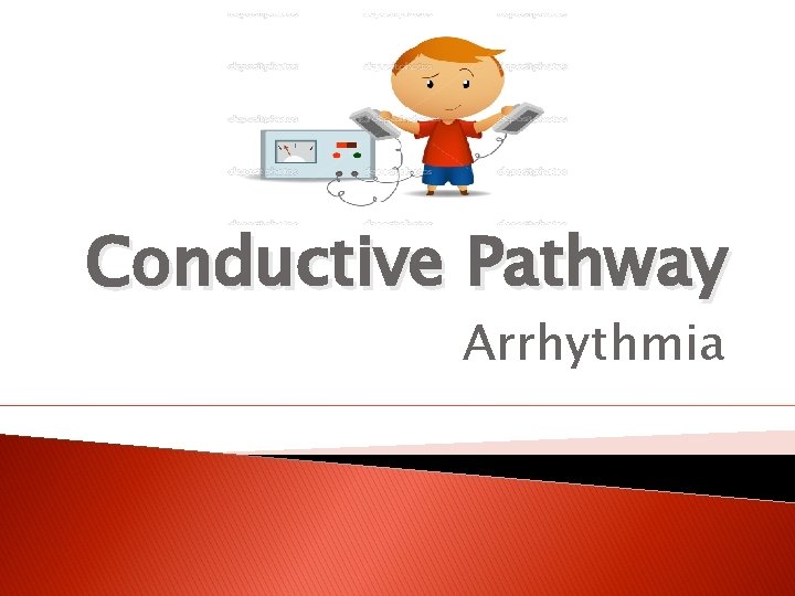 Conductive Pathway Arrhythmia 