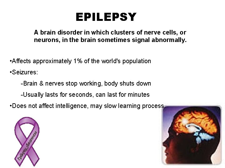 EPILEPSY A brain disorder in which clusters of nerve cells, or neurons, in the