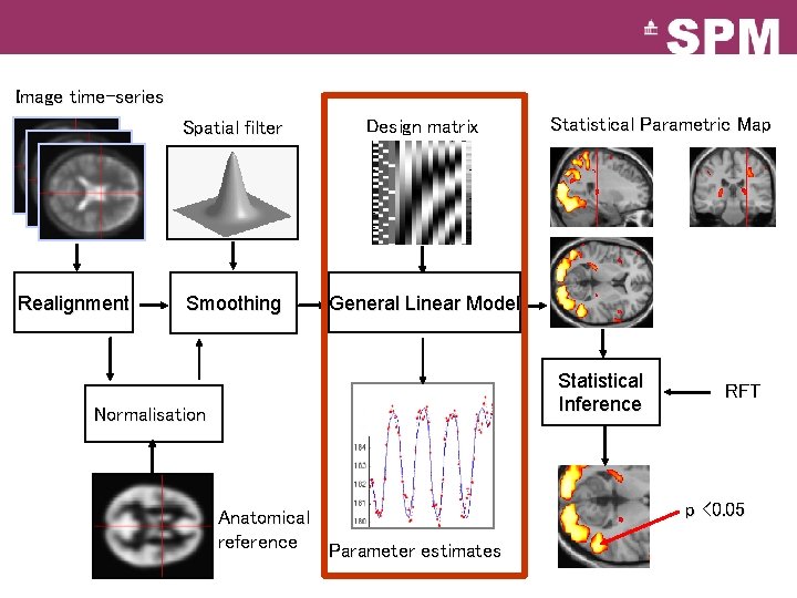 Image time-series Realignment Spatial filter Design matrix Smoothing General Linear Model Statistical Parametric Map