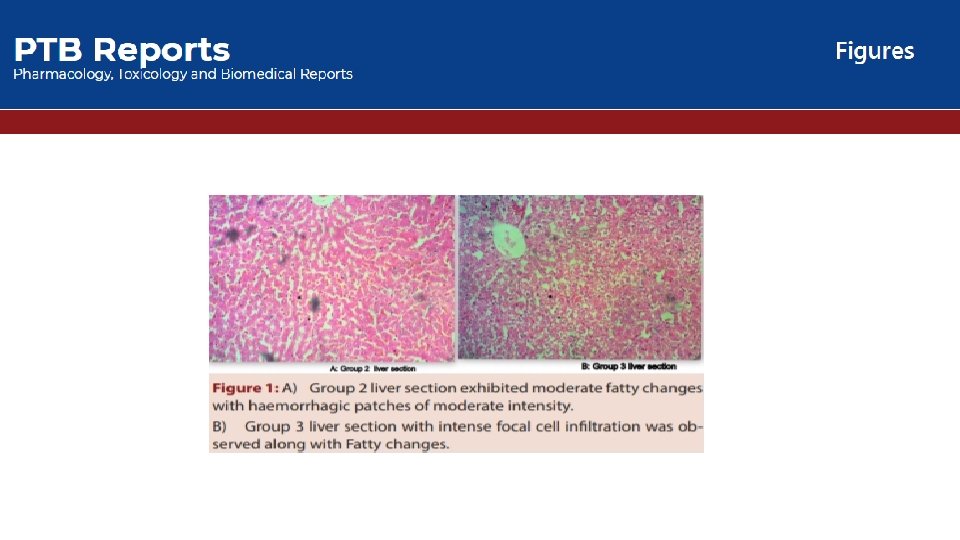 Evaluation of Metabolic Syndrome Signs in two Different