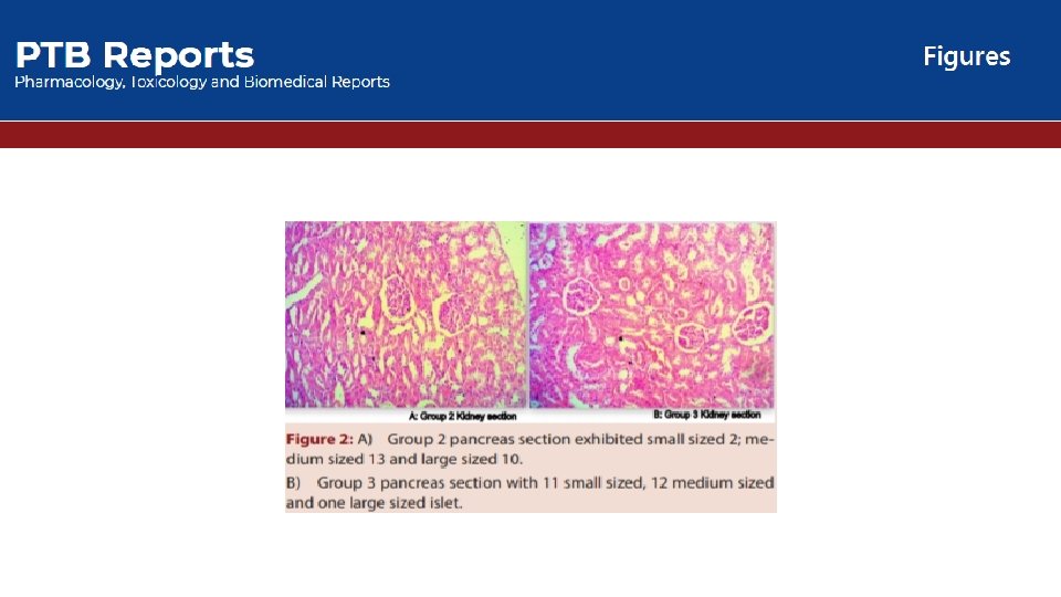 Evaluation of Metabolic Syndrome Signs in two Different