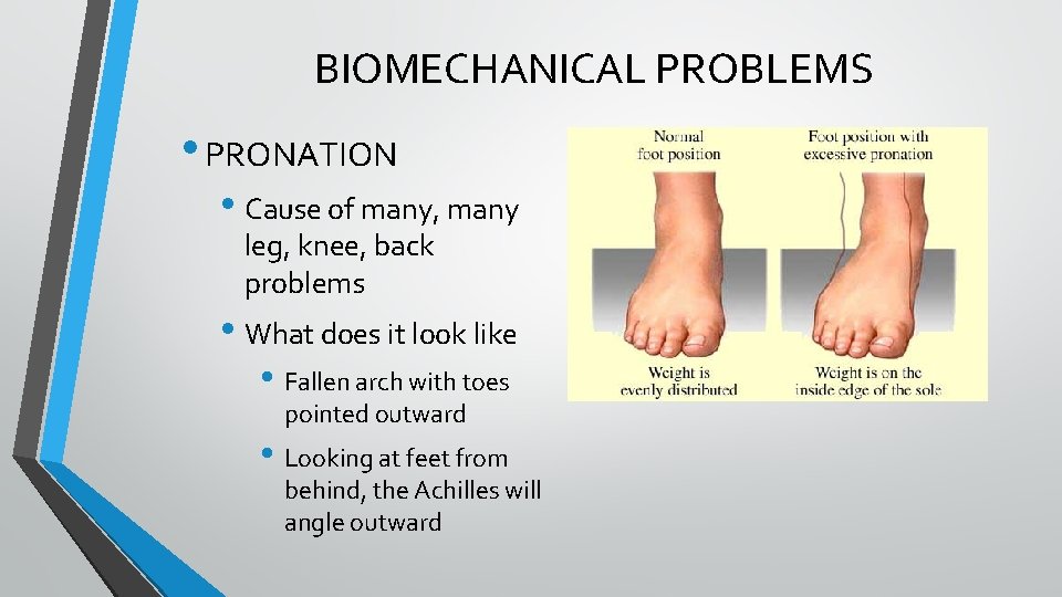 BIOMECHANICAL PROBLEMS • PRONATION • Cause of many, many leg, knee, back problems • BIOMECHANICAL PROBLEMS • PRONATION • Cause of many, many leg, knee, back problems •
