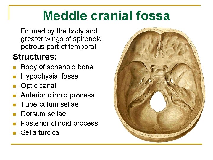 Meddle cranial fossa Formed by the body and greater wings of sphenoid, petrous part