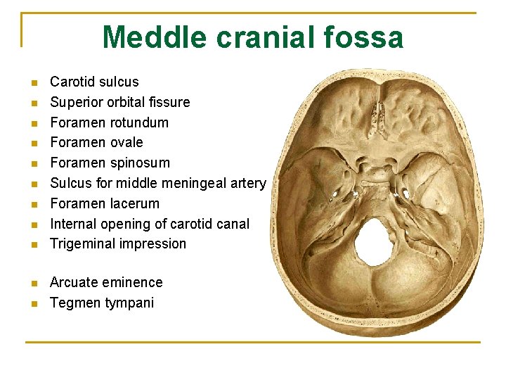 Meddle cranial fossa n n n Carotid sulcus Superior orbital fissure Foramen rotundum Foramen