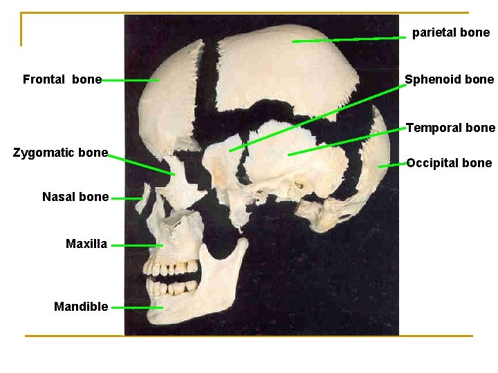 parietal bone Frontal bone Sphenoid bone Temporal bone Zygomatic bone Nasal bone Maxilla Mandible
