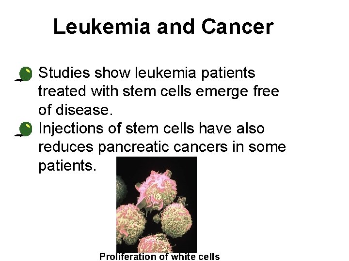 Leukemia and Cancer • Studies show leukemia patients treated with stem cells emerge free
