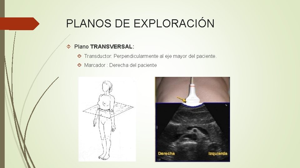PLANOS DE EXPLORACIÓN Plano TRANSVERSAL: Transductor: Perpendicularmente al eje mayor del paciente. Marcador :