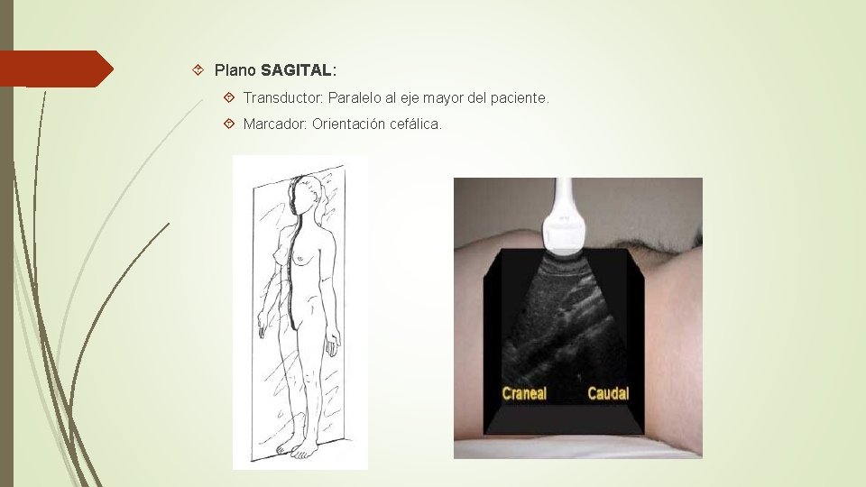  Plano SAGITAL: Transductor: Paralelo al eje mayor del paciente. Marcador: Orientación cefálica. 