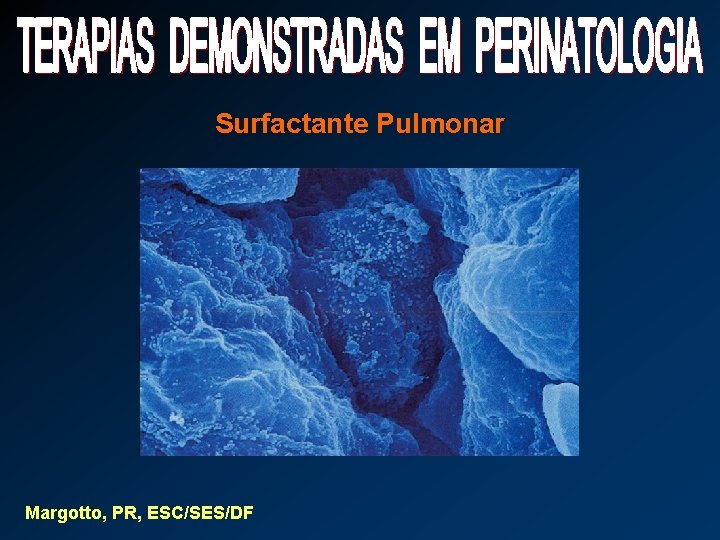 Surfactante Pulmonar Margotto, PR, ESC/SES/DF 