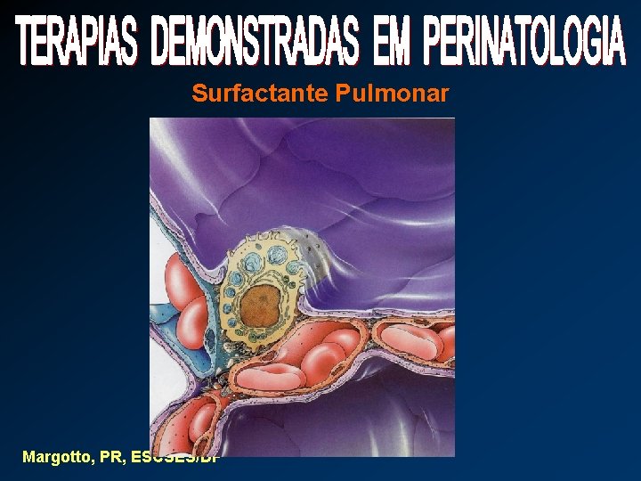 Surfactante Pulmonar Margotto, PR, ESCSES/DF 