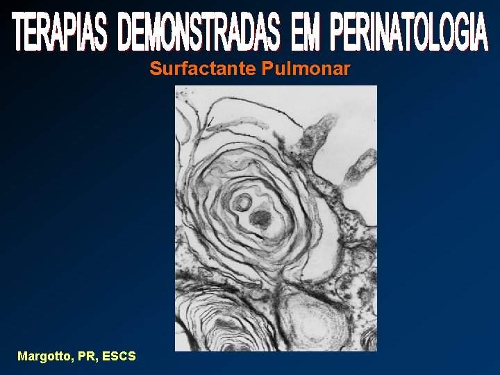 Surfactante Pulmonar Margotto, PR, ESCS 