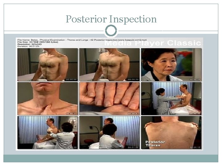 Posterior Inspection 