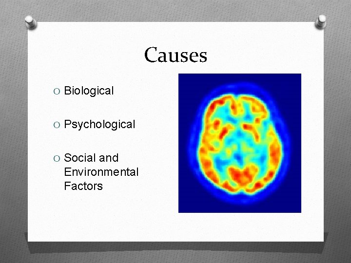 Causes O Biological O Psychological O Social and Environmental Factors 