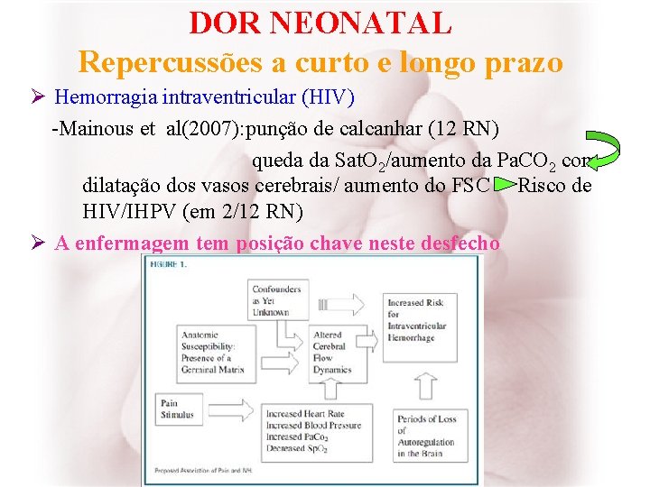 DOR NEONATAL Repercussões a curto e longo prazo Ø Hemorragia intraventricular (HIV) -Mainous et