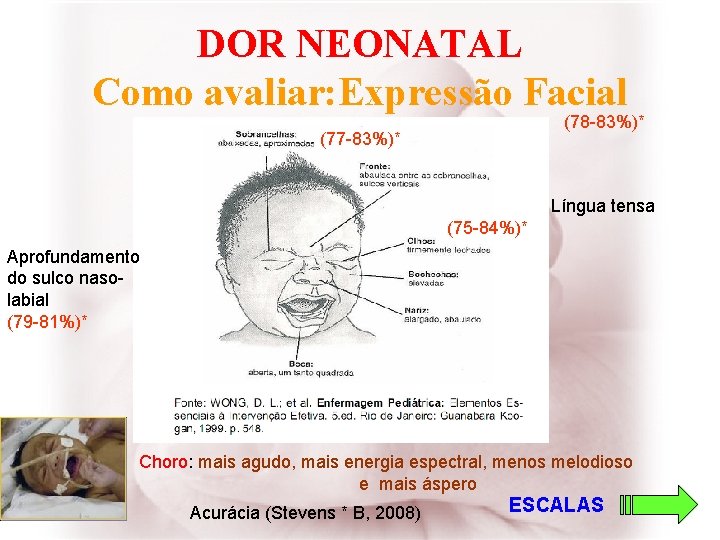 DOR NEONATAL Como avaliar: Expressão Facial (78 -83%)* (77 -83%)* Língua tensa (75 -84%)*