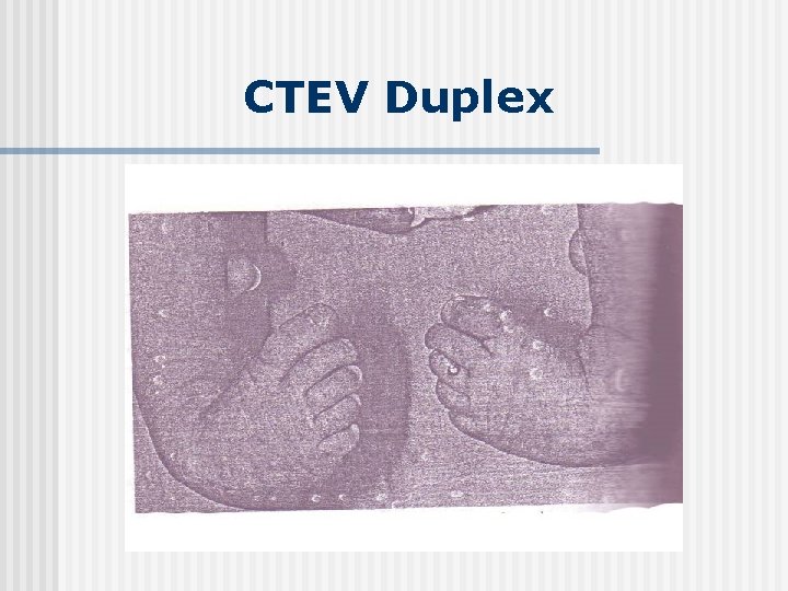 CTEV Duplex 