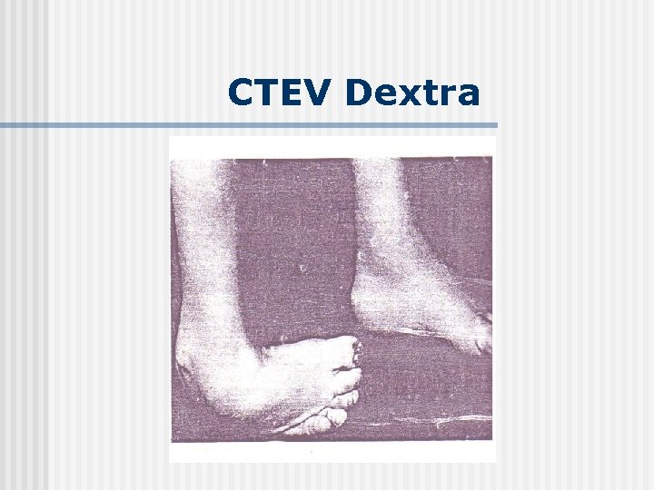 CTEV Dextra 