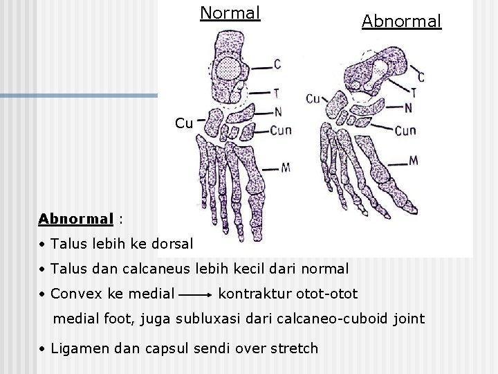 Normal Abnormal Cu Abnormal : • Talus lebih ke dorsal • Talus dan calcaneus