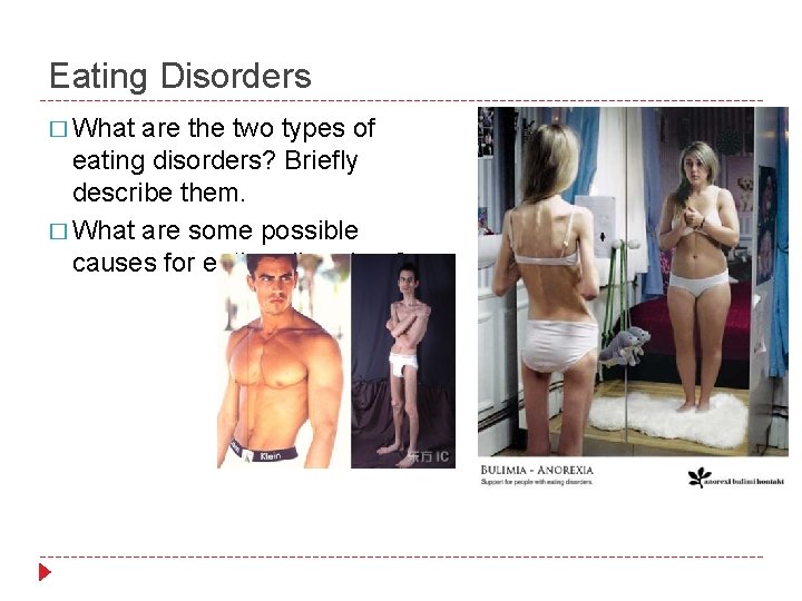 Eating Disorders � What are the two types of eating disorders? Briefly describe them.