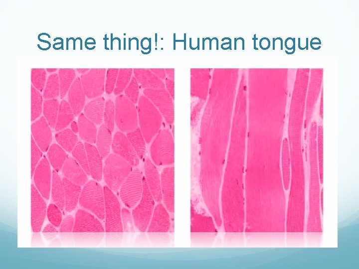 Same thing!: Human tongue 