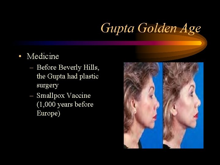 Gupta Golden Age • Medicine – Before Beverly Hills, the Gupta had plastic surgery